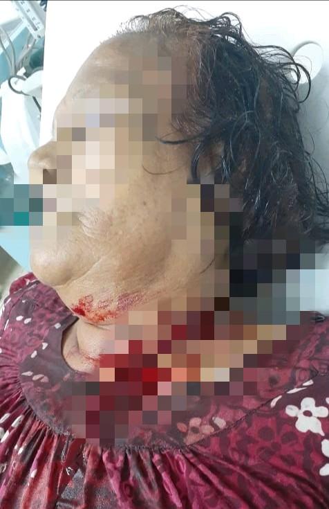 Sayat Kakak Pakai Cutter, ZS Meringkuk di Sel