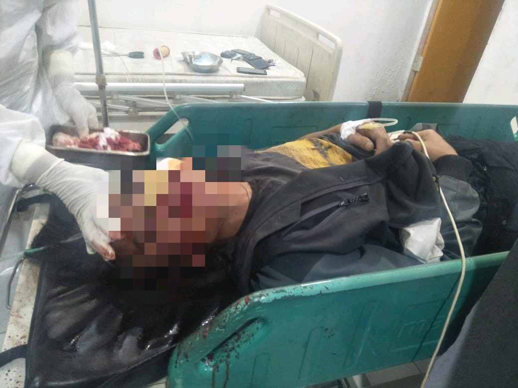 Tabrakan di Jalan Rakutta Brahmana, Pria Warga Desa Kacaribu Meninggal di RSU Kabanjahe