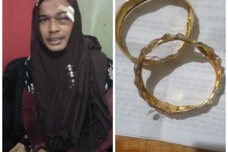 Berdandan Mirip Wanita, Seorang Warga Marelan Larikan 20 Gram Emas