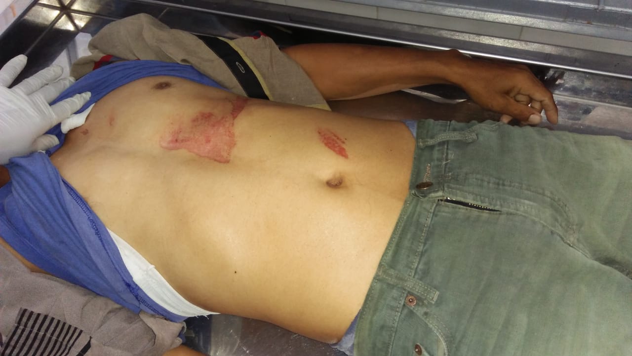 Pengendara Sepeda Motor Tabrak Truck Parkir, Wadi Tewas di Jalan Alternatif Tongkoh