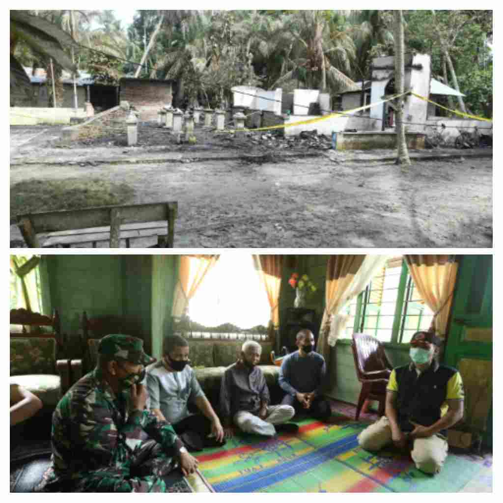 Biaya Perawatan Korban Kebakaran Sei Kepayang Ditanggung Pemkab Asahan