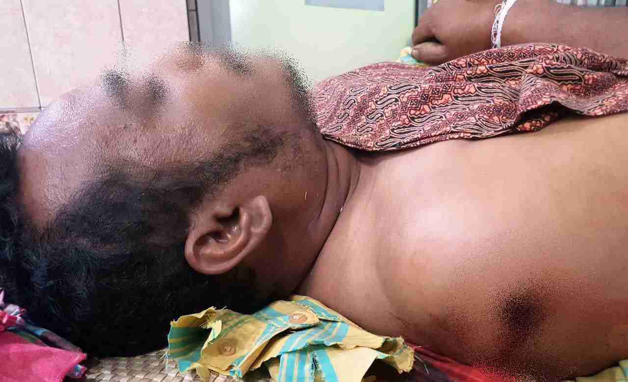 Gara-gara Melintas Lokasi Ladang, Nyawa Bebas Sembiring Melayang dengan Alat Tojok Sawit