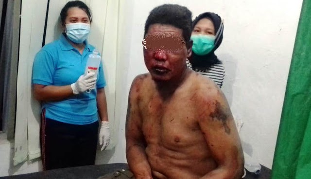 Kepergok Mencuri Sepeda Motor, Kusdi Simbolon Dihajar Warga Kampung Namu Terasi Hingga Babak Belur