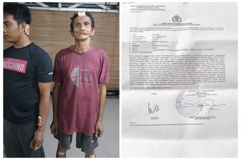 Dikeroyok Sampai Luka di Komplek Graha Jermal, Korban Minta Kapolda Sumut Tangkap Pelaku