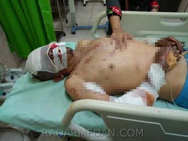 Peristiwa Ledakan Tabung Gas di Binjai, BP Jamsostek Bergerak Cepat Pantau Korban di TKP