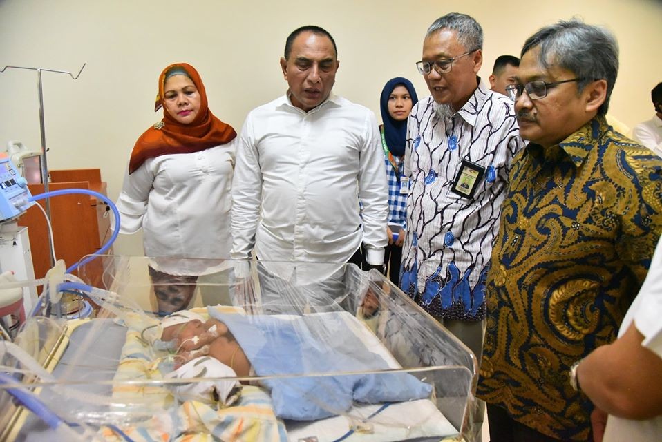 Gubernur Besuk Bayi Kembar Siam Asal Labuhanbatu