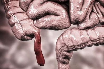 ilmuwan-ungkap-fungsi-usus-buntu-ternyata-sangat-vital-bagi-kesehatan-lzw.jpg