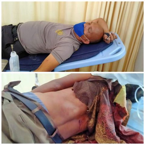 Dua Butir Peluru Lumpuhkan Tersangka yang  Menikam Polisi