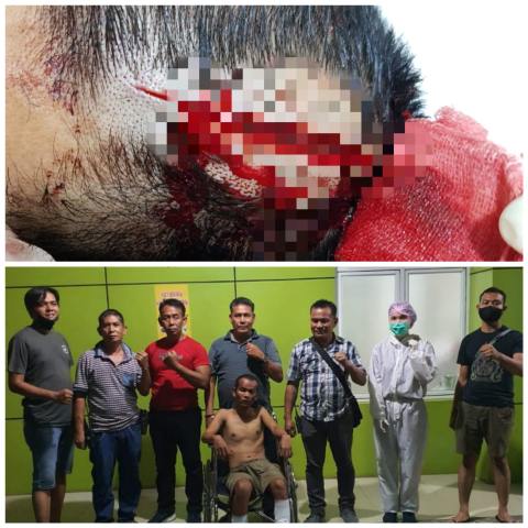 Tim Tekab Polsek Medan Area Tembak Kedua Kaki Pelaku Pencurian